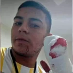 Quién es el “Negro Juan”, el delincuente acusado de cortarle cuatro dedos a un repartidor con un machete