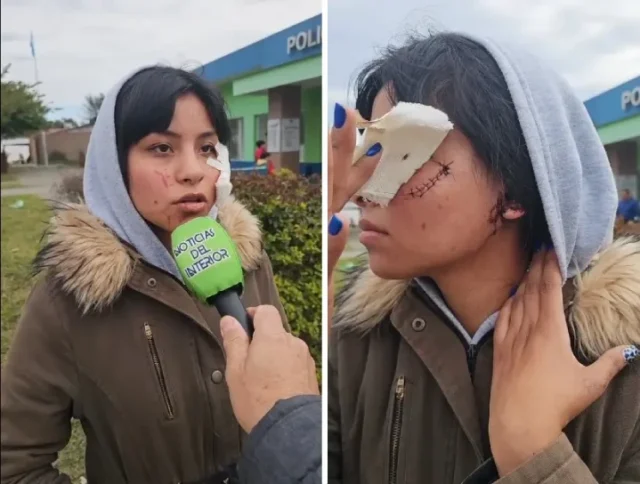 Nadia Muñoz fue atacada por otras mujeres a la salida de un boliche
